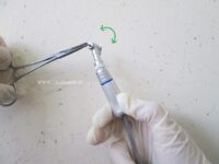راهنمای آموزش رفع گیر کردن فرز دندانپزشکی در داخل آنگل