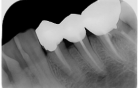 اسکنر فسفر پلیت PSP Apixia Dental Phosphor Plate Scanner Digirex دندانپزشکی رادیوگرافی مشهد