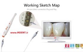 دوربین داخل دهانی Dental Intraoral Camera SmartCam HDI-110 handy هندی