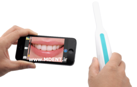 دندانپزشکی Intra oral cameras dental maad wifi دوربین داخل دهانی بیسیم