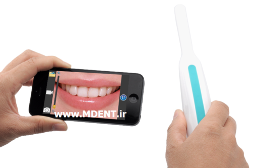 دندانپزشکی Intra oral cameras dental maad wifi دوربین داخل دهانی بیسیم