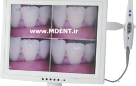 دوربین داخل دهانی MLG dental intraoral camera M-958 بهمراه مانیتور