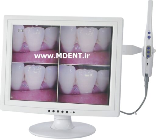 دوربین داخل دهانی MLG dental intraoral camera M-958 بهمراه مانیتور