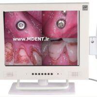 دوربین داخل دهانی MLG dental intraoral camera M-958 بهمراه مانیتور