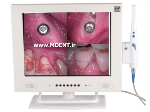 دوربین داخل دهانی MLG dental intraoral camera M-958 بهمراه مانیتور