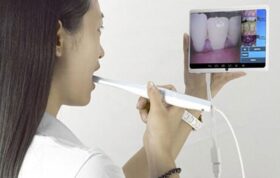 CF-683A دوربین داخل دهانی با اتصال مستقیم به تلویزیون و موبایل و کامپیوتر dental Intra Oral