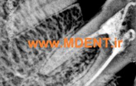 سنسور دیجیتال هندی RVG APS CMOS Sensor Digital Dental X-ray HDR500 HANDY دندان پزشکی
