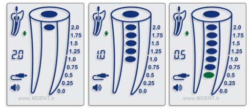 اپکس فایندر لوکیتور دمپکس انگلیس DEMPEX DENTAL APEX LOCATOR FINDER demdental endo دندانپزشکی