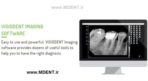 آرویجی Visiodent France original RSV5 Dental digital X-Ray Sensor RVG سنسور دندانپزشکی رادیوگرافی ویزیودنت