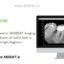 آرویجی Visiodent France original RSV5 Dental digital X-Ray Sensor RVG سنسور دندانپزشکی رادیوگرافی ویزیودنت