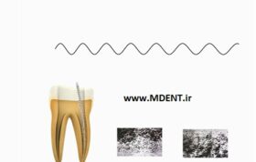 جرمگیر نوری دندانپزشکی خارج از یونیتی WOODPECKER مدل DTE D600 LED dental woodpecker ultrasonic scaler DTE D600 LED