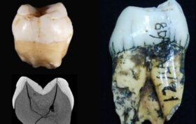 کشف دندان ۶۳ هزار ساله در اندونزی