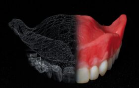 حل مشکل زندانیان تگزاس با دندان مصنوعی ۳D!