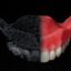 حل مشکل زندانیان تگزاس با دندان مصنوعی ۳D!