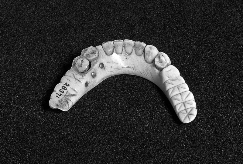 استفاده از دندان مرده‌ها برای ساخت دندان مصنوعی!