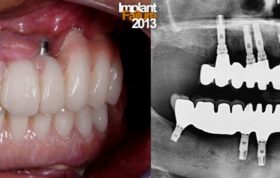 کاهش اعتماد انگلیسی‌ها به دندان‌پزشکان