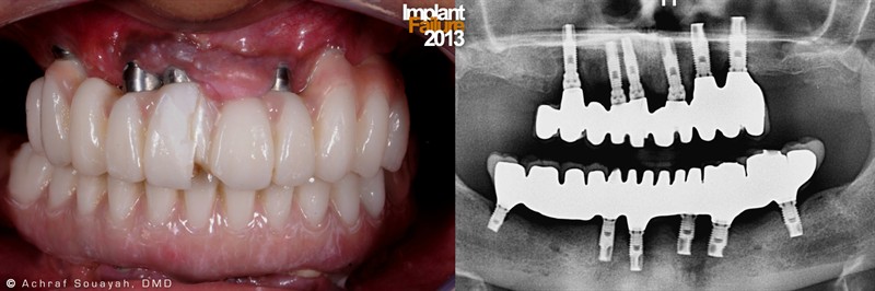 کاهش اعتماد انگلیسی‌ها به دندان‌پزشکان