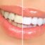 راه‌های موفقیت در یک درمان سهل و ممتنع دندان‌پزشکی زیبایی