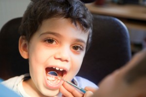کودکان مازنی ۲برابرهمسالانشان دندان پوسیده دارند