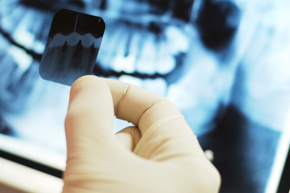عکس دندان به دندانپزشک چه می‌گوید؟