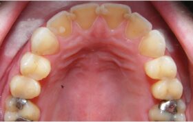 ‎نقش دندانپزشک در درمان بیماران دچار اختلال‌ اشتها