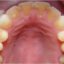‎نقش دندانپزشک در درمان بیماران دچار اختلال‌ اشتها