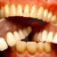 طلاق به خاطر دندان مصنوعی