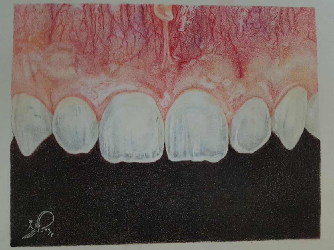 نقش دندان بر اینستاگرام