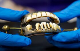 چند ماجرای بامزه تاریخی درباره دندان
