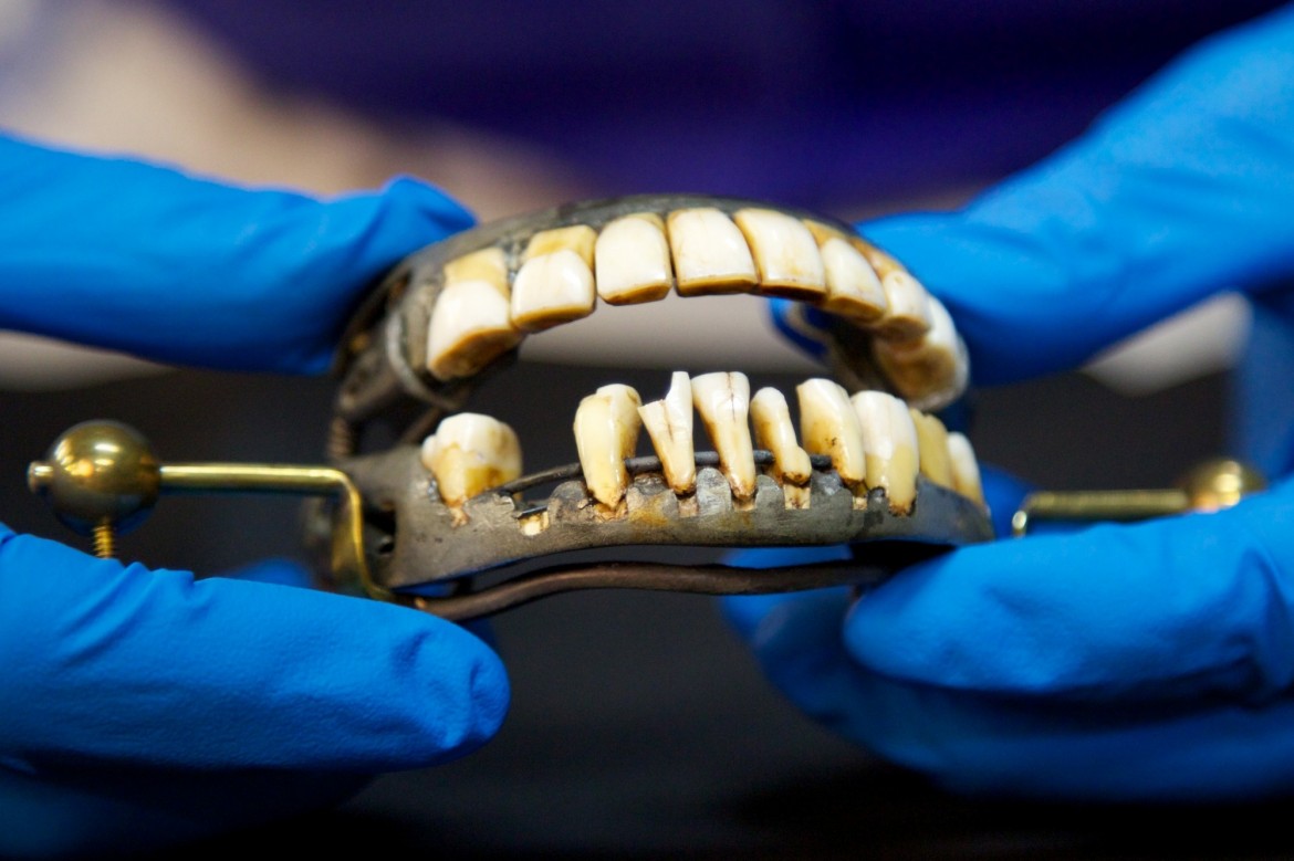 چند ماجرای بامزه تاریخی درباره دندان