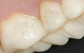 تصویر پوتین و ترامپ روی دندان یک روس