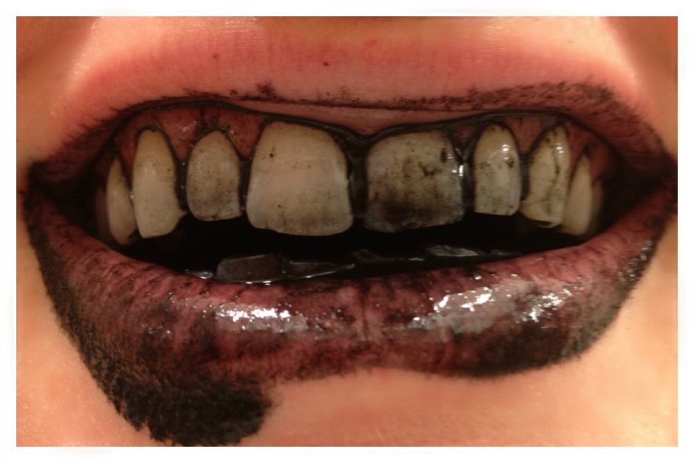 آیا زغال درمانی برای دندان‌ها مفید است؟
