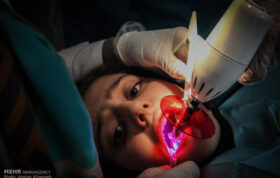 انفعال بیمه‌ها در حوزه بهداشت دهان و دندان