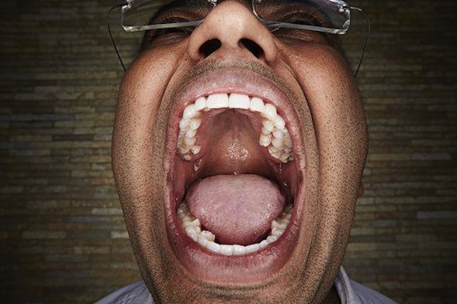 مردی با ۳۷ دندان، رکورد گینس را شکست