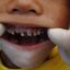 کشف ارتباط بین حوادث ناگوار دوران کودکی و از دست دادن دندان‌ها در بزرگسالی