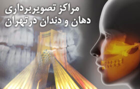 فهرست و نشانی مراکز رادیولوژی دندانپزشکی در شمال تهران