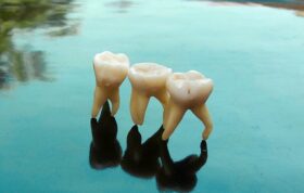 افسانه‌های دندانپزشکی ۲