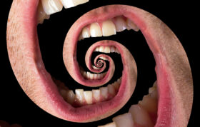 دندان‌درد سینوسی و راه درمان آن