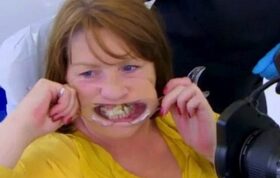 ۱۰سال چسبکاری دندان‌ها به خاطر ترس از دندانپزشک!