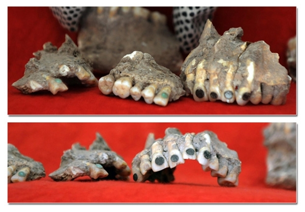 شواهدی از دندانپزشکی با قدمت ۴هزار سال
