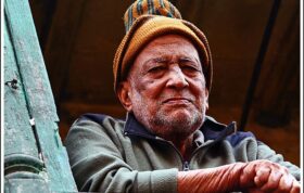 پنجاه درصد سالمندان ایرانی بی‌دندان هستند