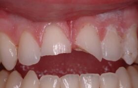 کاربرد دندانپزشکی در پزشکی قانونی
