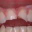کاربرد دندانپزشکی در پزشکی قانونی