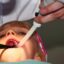 ساکشن‌های آبی یونیت‌های دندانپزشکی را حذف کنید