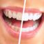 نکاتی برای سفید شدن و سفید ماندن دندان‌ها