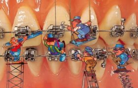 سراب ارتودنسی: تردید درباره سودمندی درمان ارتودنسی و حرفه دندانپزشکی