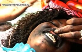 درمان زیبایی در سنگال: تتوی سیاه لثه برای زیبایی لبخند