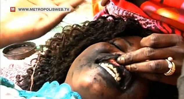 درمان زیبایی در سنگال: تتوی سیاه لثه برای زیبایی لبخند