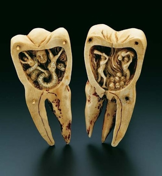 اسطورۀ کرم و دندان درد
