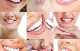 نگاهی به درمان‌های زیبایی در دندانپزشکی از دیدگاه جامعه‌‌شناسی سلامت